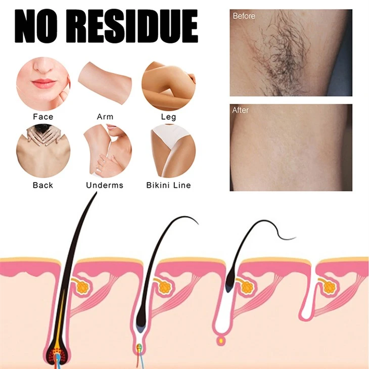 Herbal Painless Hair Removal Spray